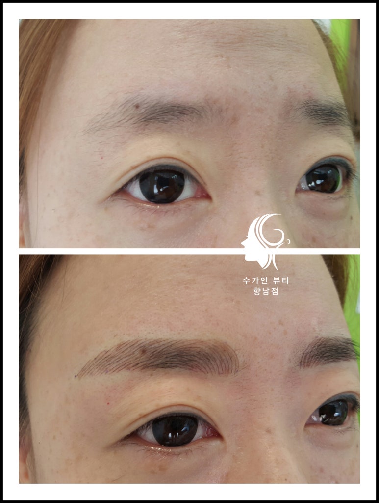 수가인 이미지