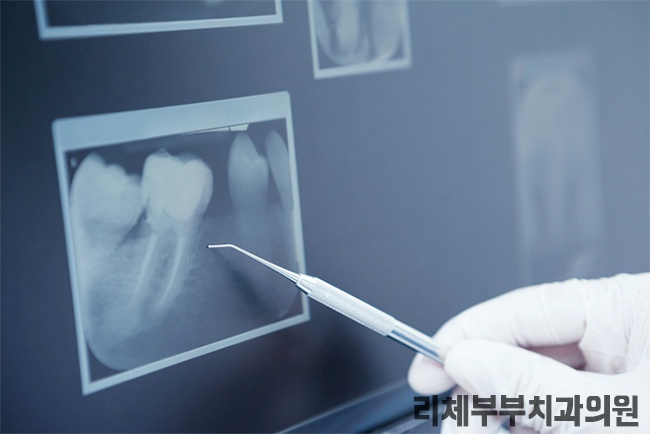 리체부부치과의원 이미지