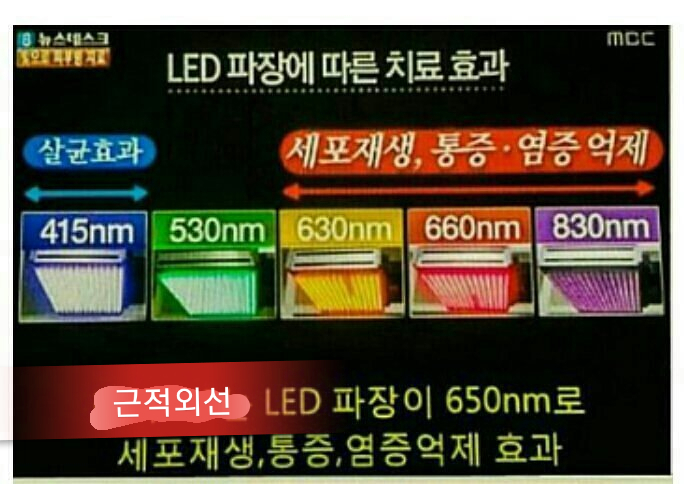 에스케어 이미지