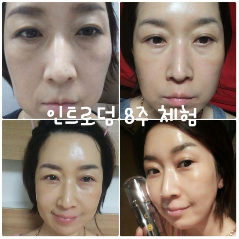 엔케이더블유 이미지