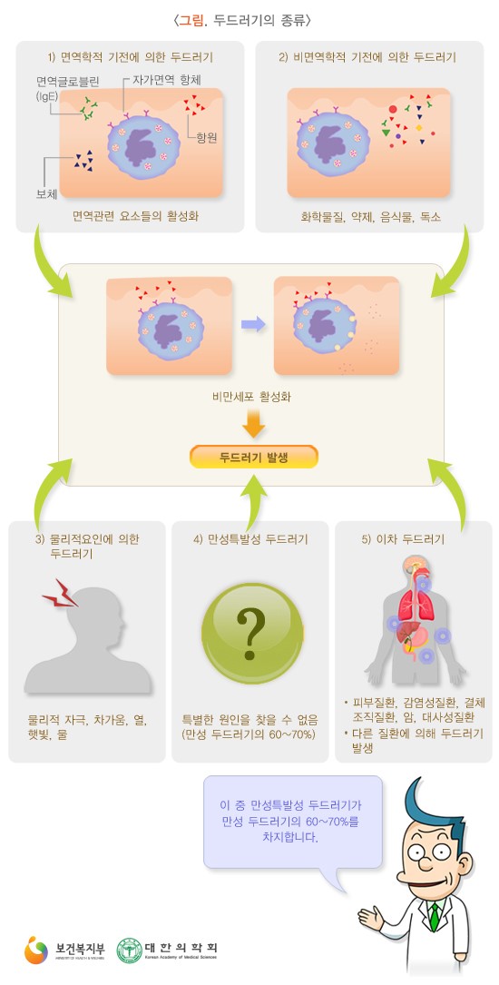진동성 이미지