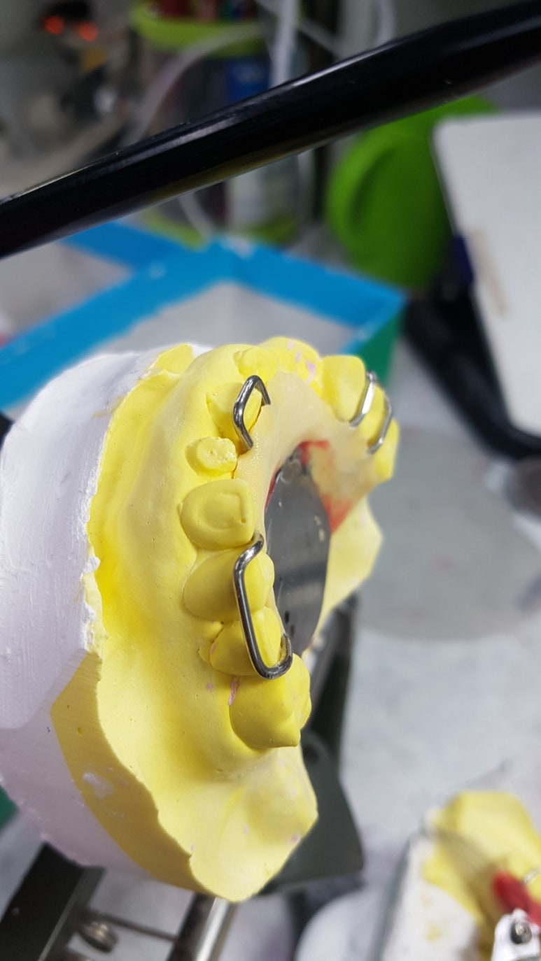 Oral design 치과기공소 네이버 블로그