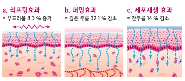 에스테틱 더힐 이미지