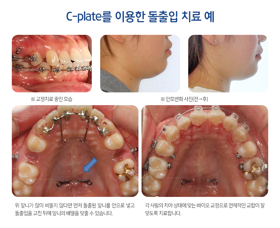 페이스라인치과의원 이미지
