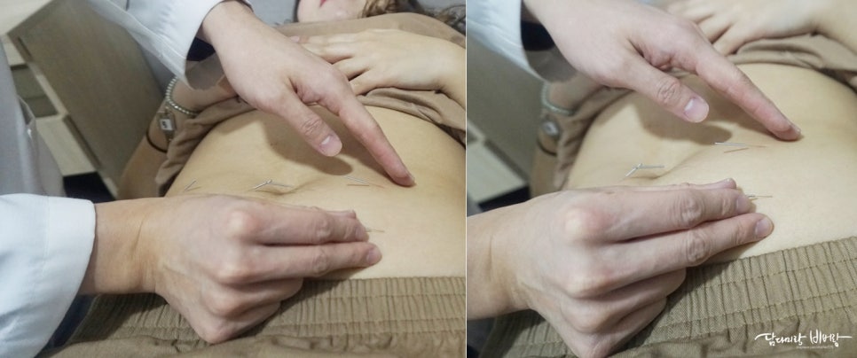 미앤네이처한의원강서점 이미지