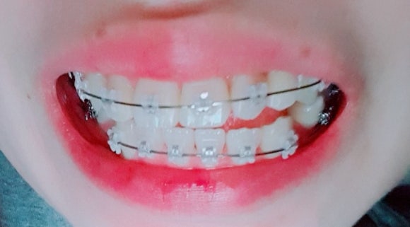 불당치과교정과치과의원 이미지