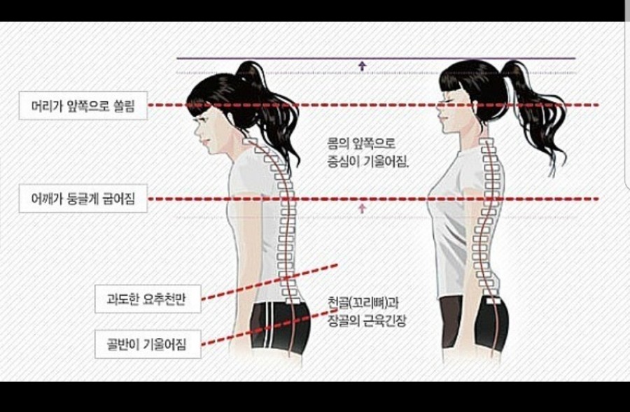 레몬트리짐 이미지
