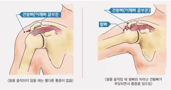 JLP스포츠 이미지