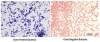 gram positive vs gram negative colors