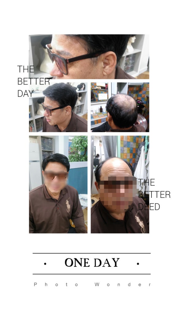 두림가발 이미지
