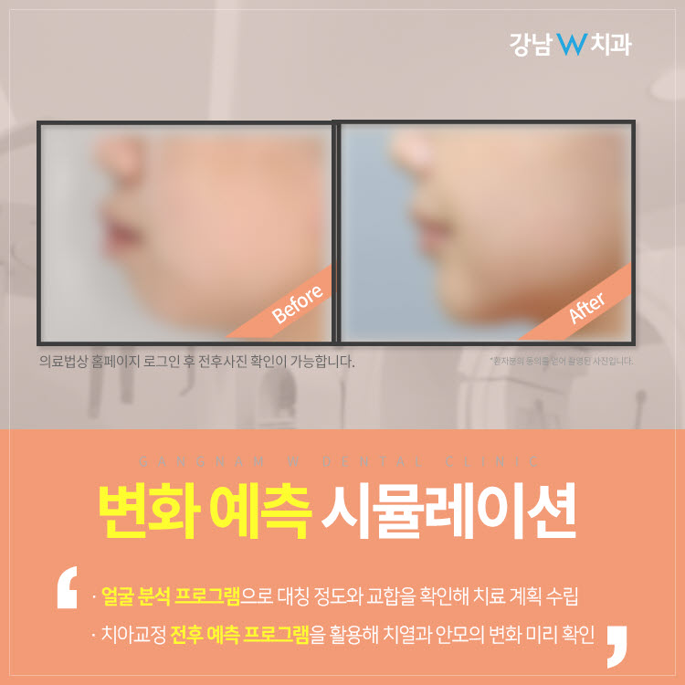 강남더블유치과 이미지