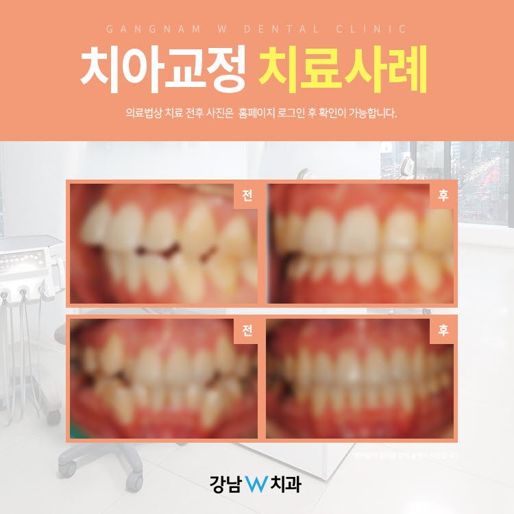 강남더블유치과 이미지