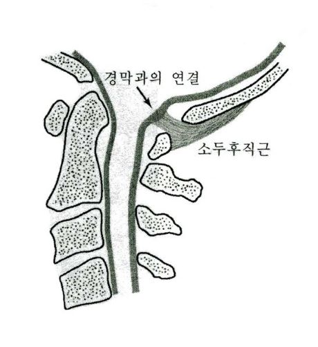 휴드림 이미지