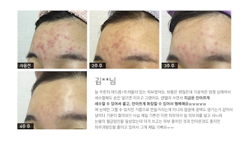 멀티팜 이미지