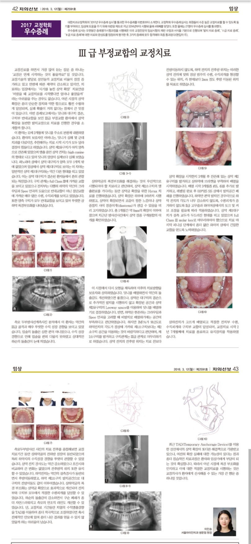 서울하이안치과 이미지