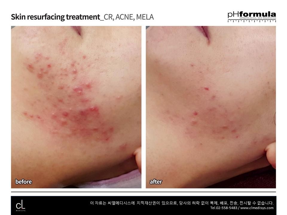 스킨갤러리 이미지