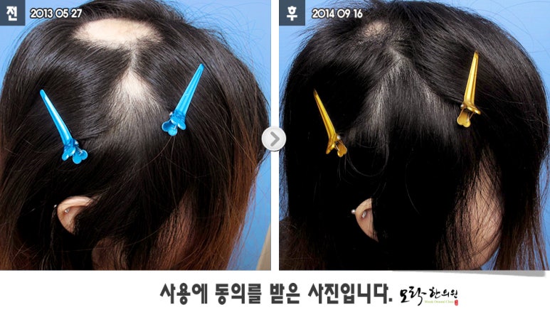 원형한의원 이미지