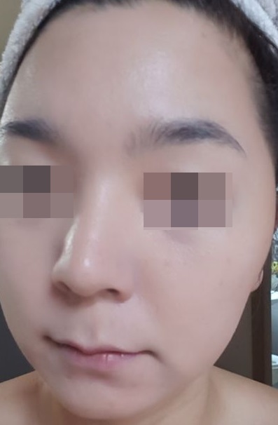 비비크린 이미지
