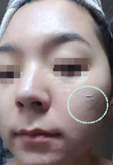 비비크린 이미지
