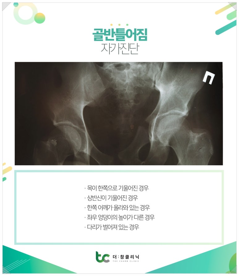 참클리닉 이미지