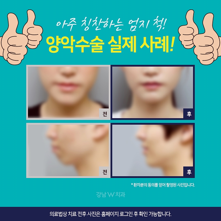 강남더블유치과 이미지