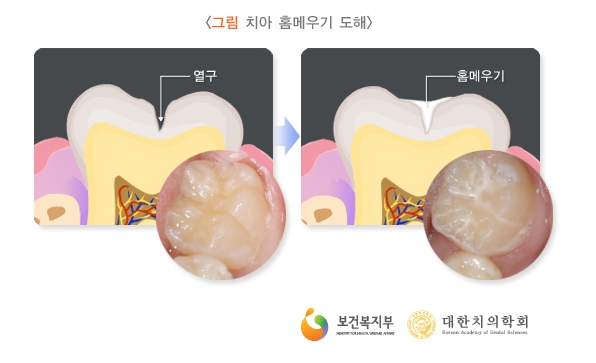 박치과 이미지