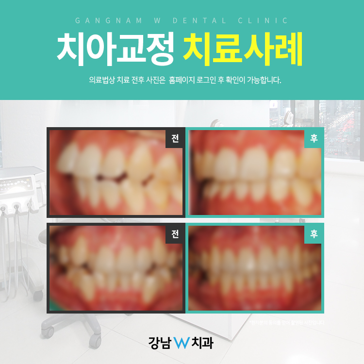 강남더블유치과 이미지