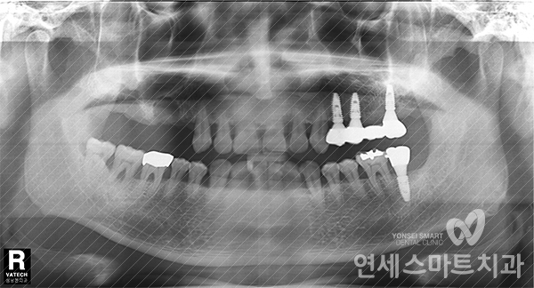 연세간석치과 이미지
