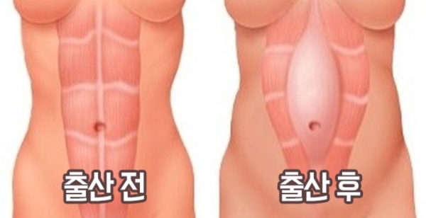 안산출장마사지 이미지