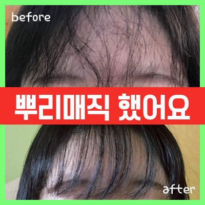 이훈ALL30000 이미지
