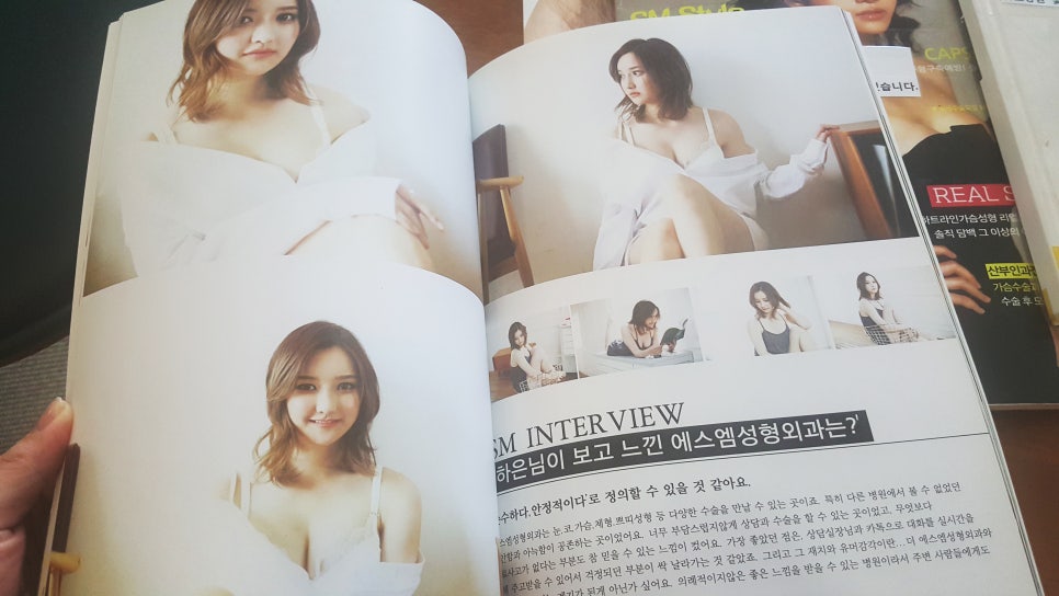 에스엠성형외과 이미지