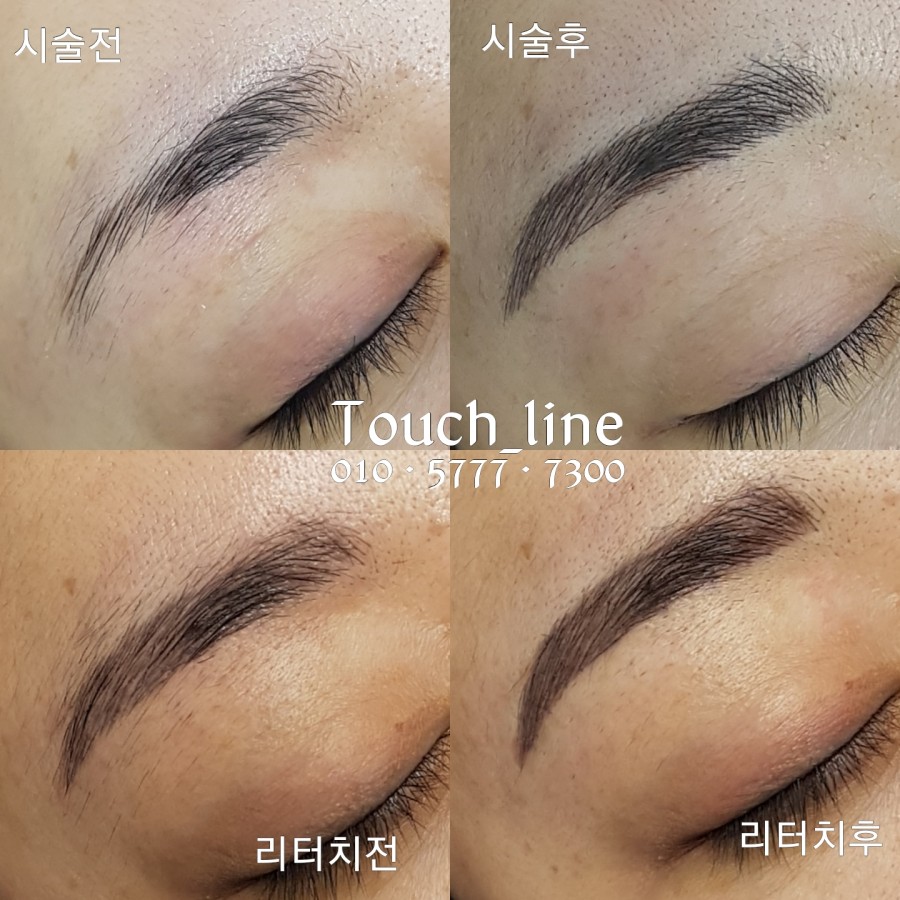 터치라인(Touch line) 이미지