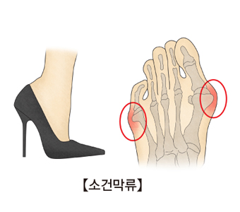 바렌티노 이미지