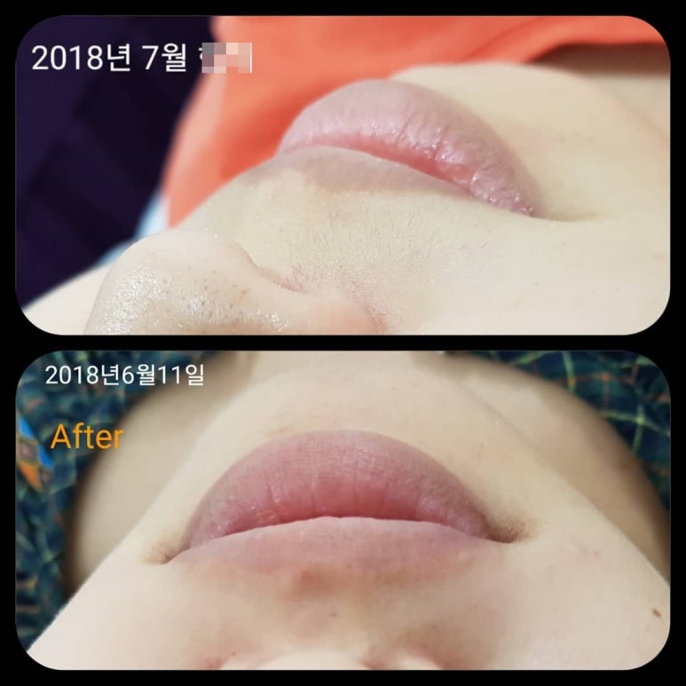 예담네일 이미지