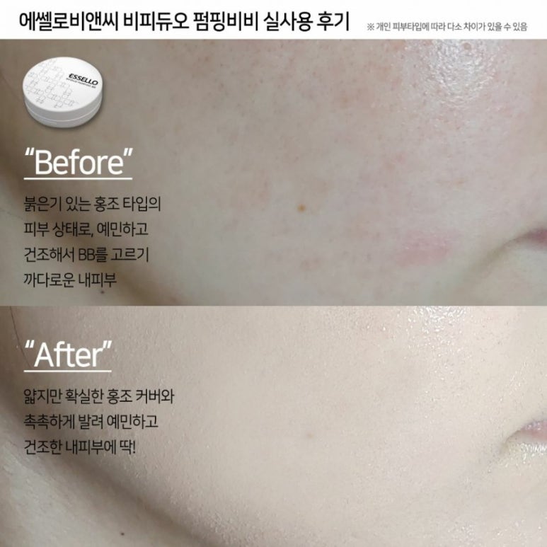 비피엔씨 이미지
