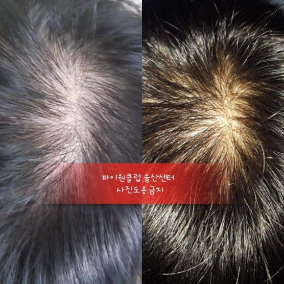 톡스헤어매직 이미지