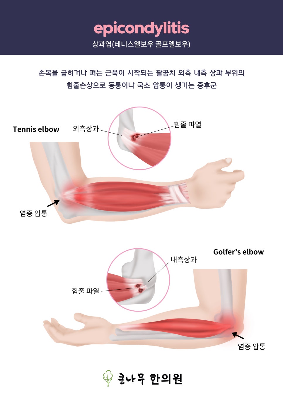 큰나무한의원 이미지
