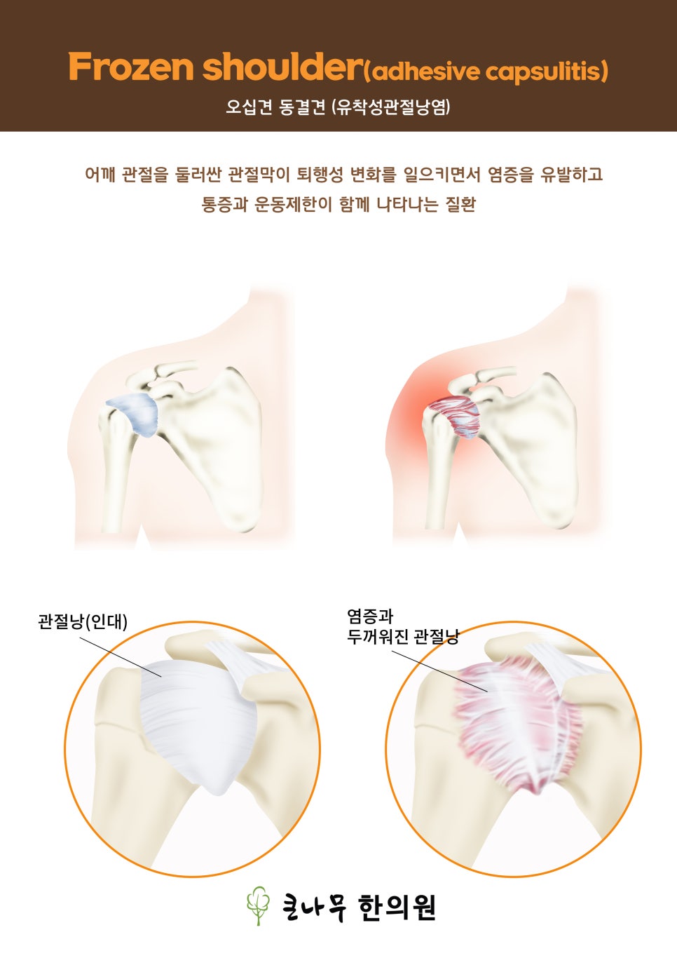 큰나무한의원 이미지