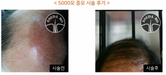 쎄다모 이미지