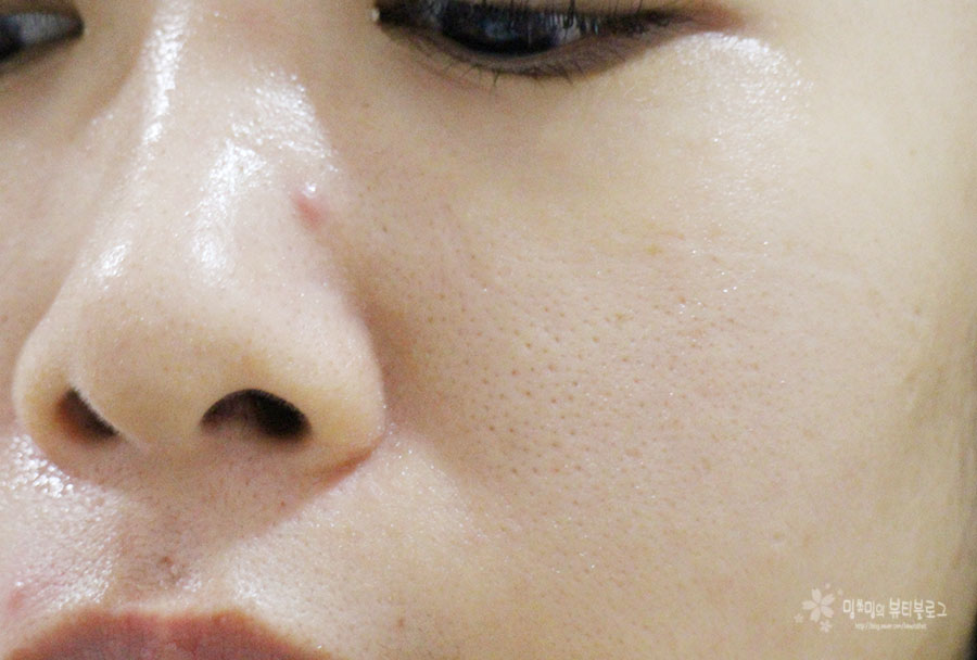 꽃결피부 이미지