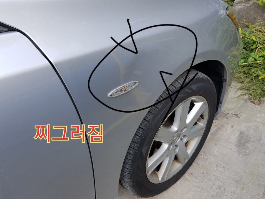 신의손덴트 이미지