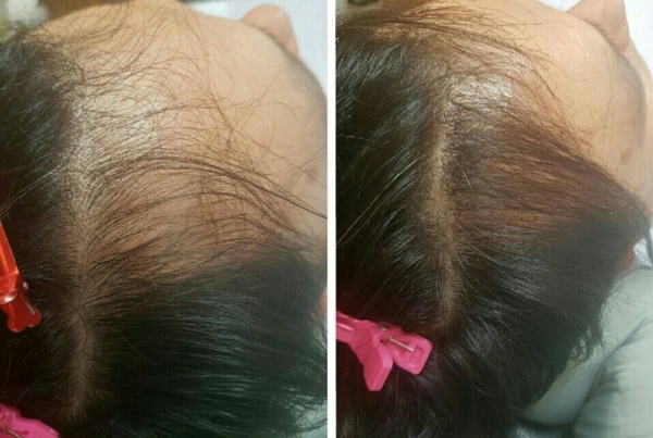 헤어수아 이미지