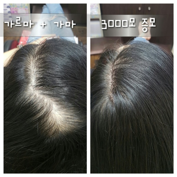 헤어수아 이미지