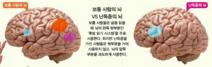바이온스 이미지