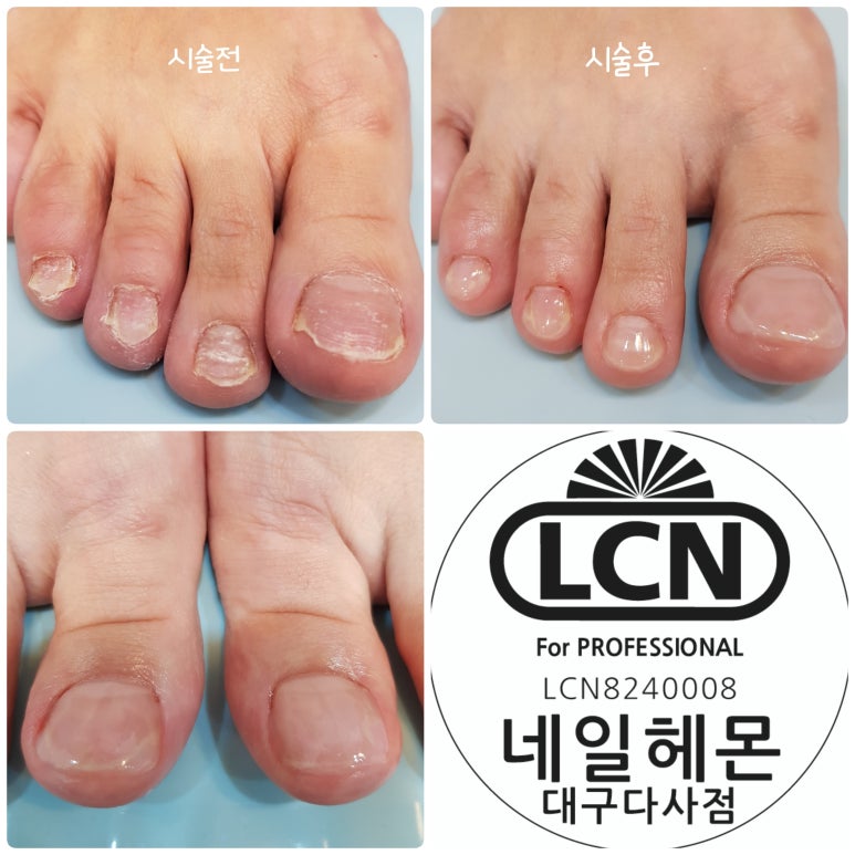 네일헤몬대구 이미지
