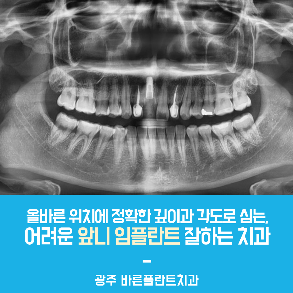 바른본치과 이미지