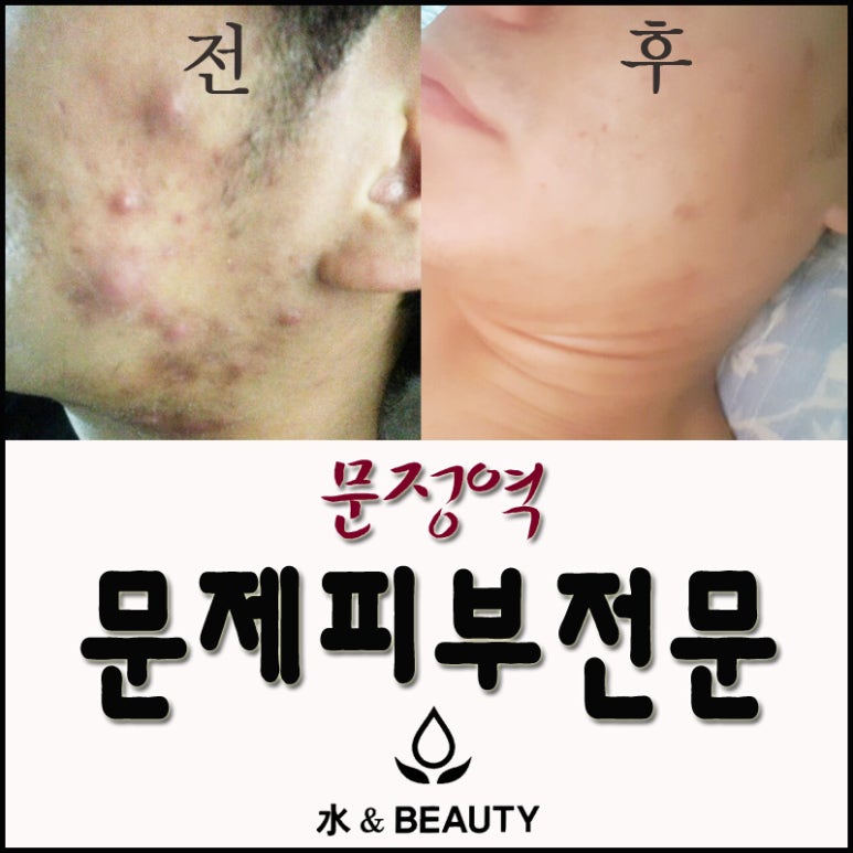 수앤테라피 이미지