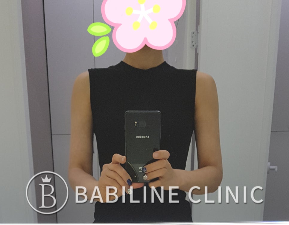 바비라인 이미지