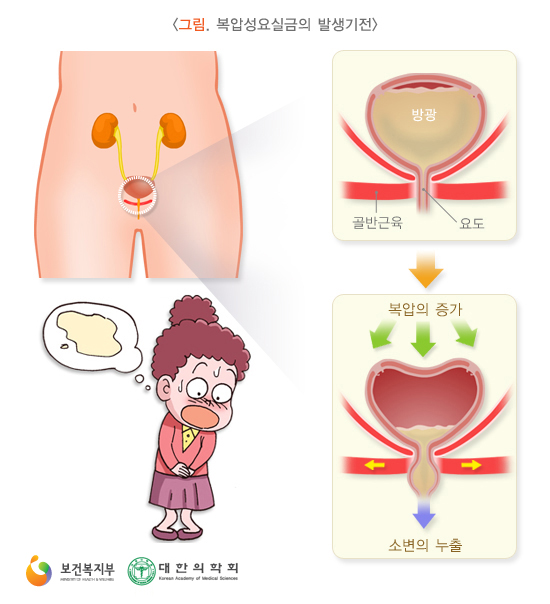 피지오스 이미지
