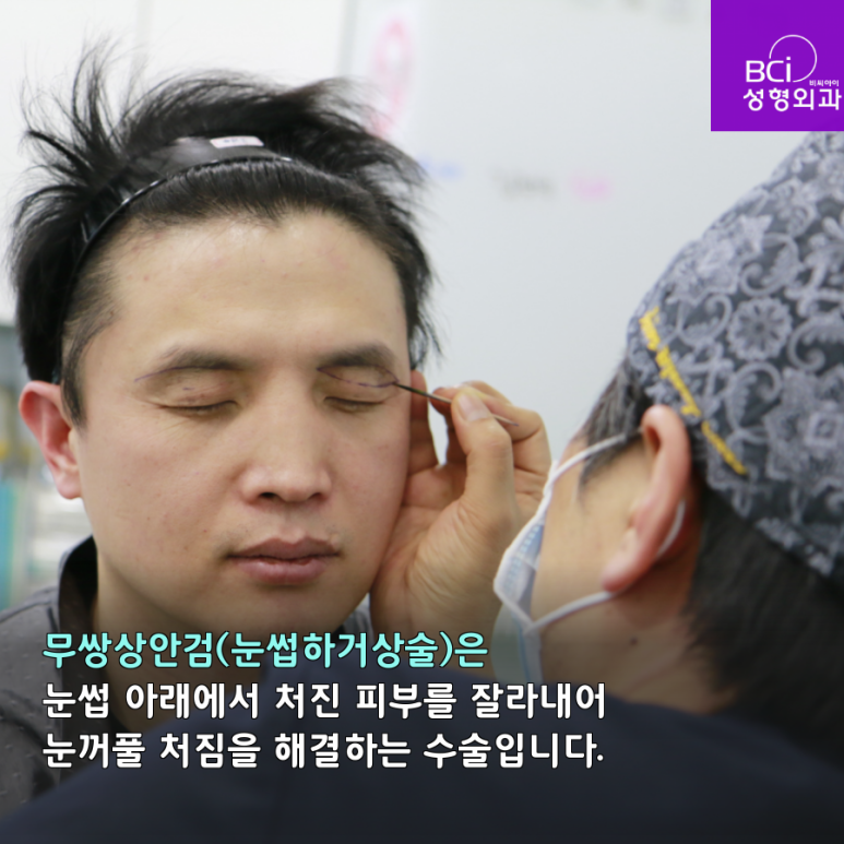 비씨아이 이미지